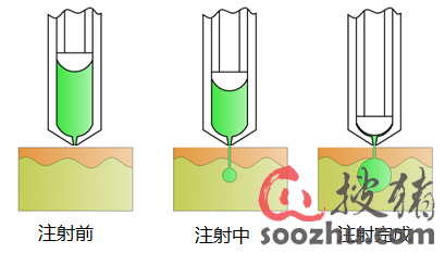 兽用无针注射器 现代化兽医医疗器械的创新与优势
